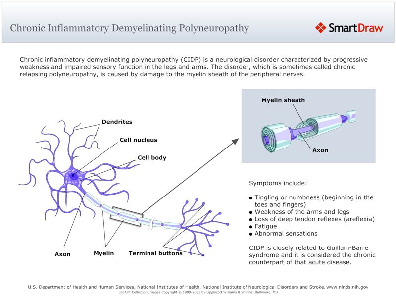 Chronic_Inflammatory_Demyelinating_Polyneuropathy