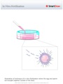 In_Vitro_Fertilization