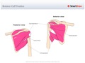 Rotator_Cuff_Tendon