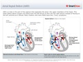 Atrial_Septal_Defect_(ASD)