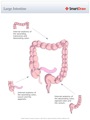 Large_Intestine