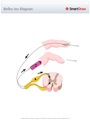 Reflex_Arc_Diagram