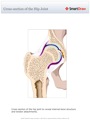 Cross-section_of_the_Hip_Joint
