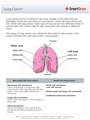 Lung_Cancer
