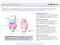 Types_of_Thyroid_Cancer
