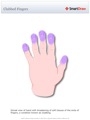 Clubbed_Fingers