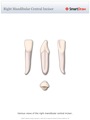 Right_Mandibular_Central_Incisor