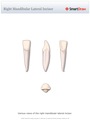 Right_Mandibular_Lateral_Incisor