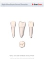 Right_Mandibular_Second_Premolar