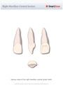Right_Maxillary_Central_Incisor