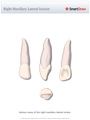 Right_Maxillary_Lateral_Incisor