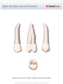 Right_Maxillary_Second_Premolar