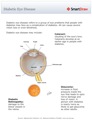 Diabetic Eye Disease