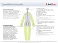 Types of Diabetic Neuropathy