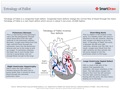 Tetralogy_of_Fallot