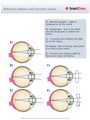 Refractive defects and Corrective lenses