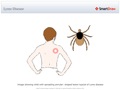 Lyme_Disease