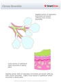 Chronic_Bronchitis