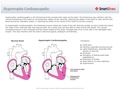 Hypertrophic_Cardiomyopathy