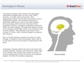 Huntington's_Disease
