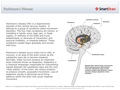 Parkinson's_Disease
