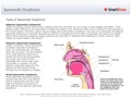 Spasmodic_Dysphonia