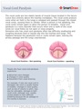 Vocal_Cord_Paralysis