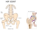 HIP_JOINT