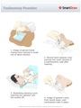 Tracheostomy_Procedure