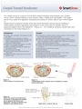 Carpal_Tunnel_Syndrome