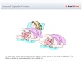 External_Cephalic_Version